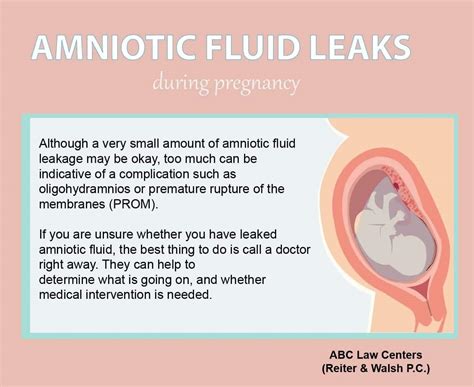 how to tell if your leaking amniotic fluid|3 Ways to Identify an Amniotic Fluid Leak